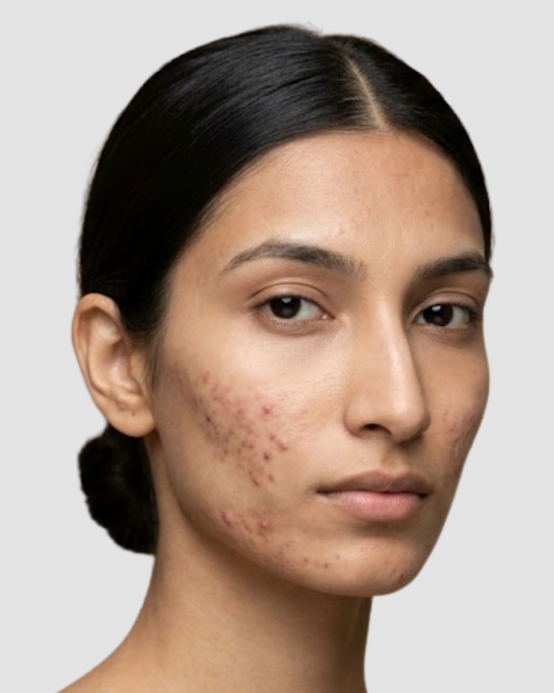 Before treatment