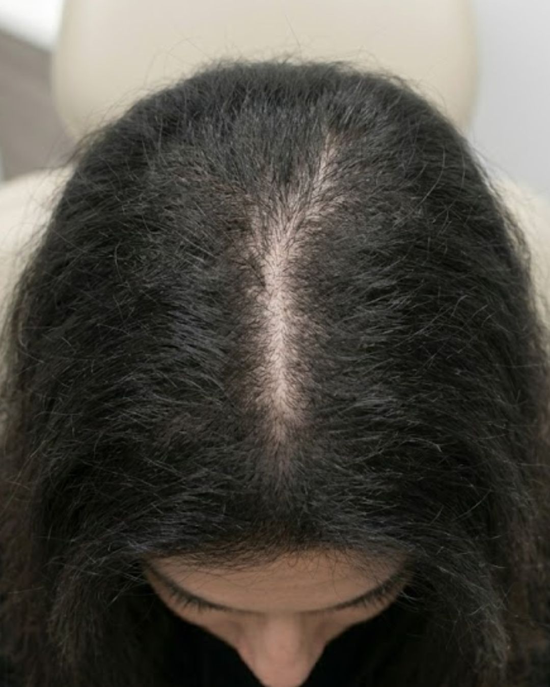 After treatment