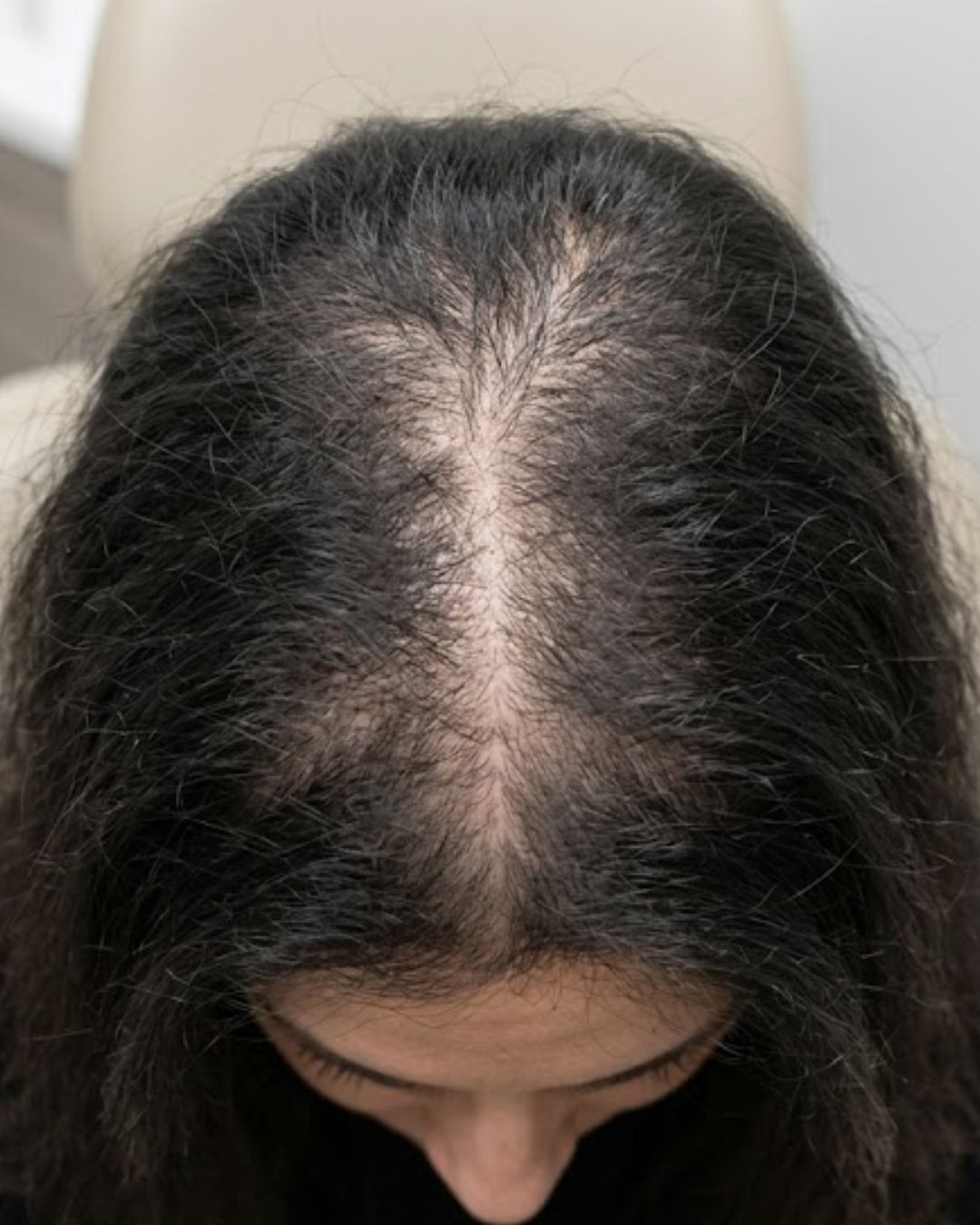 Before treatment