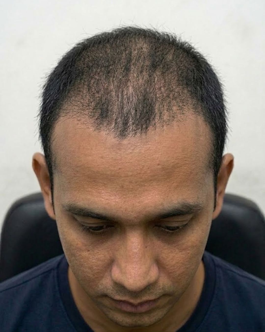 Before treatment