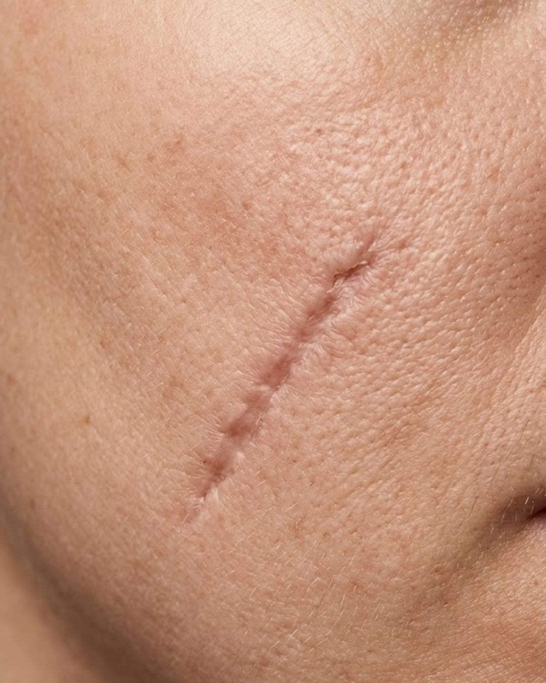 Before treatment